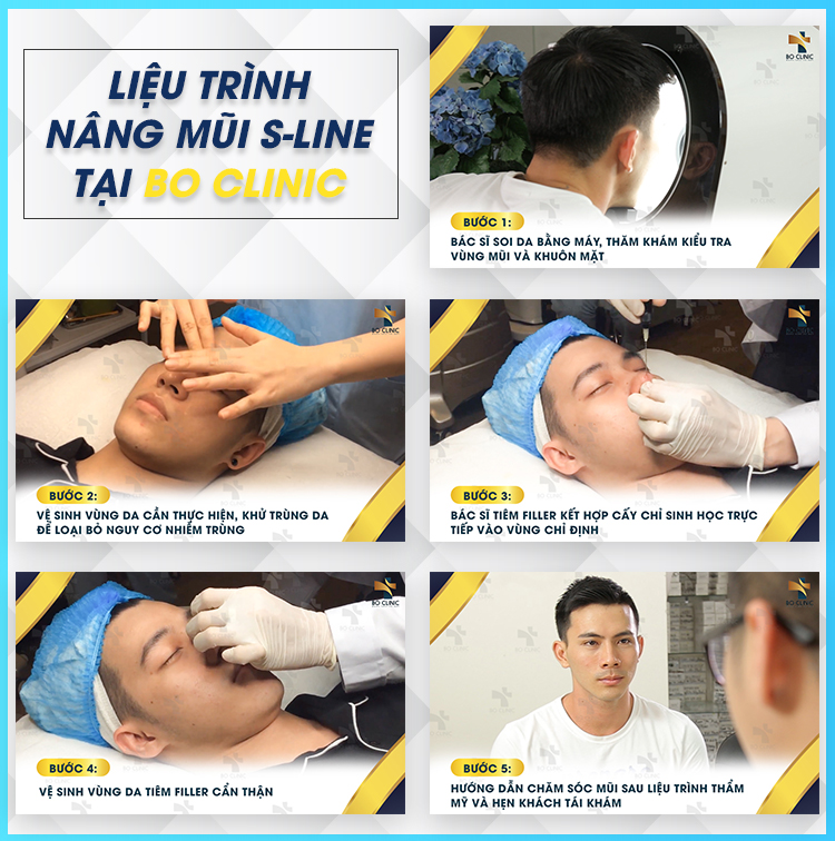Nâng mũi S Line Hàn Quốc tại Bo Clinic được các bác sĩ tạo hình chuyên nghiệp
