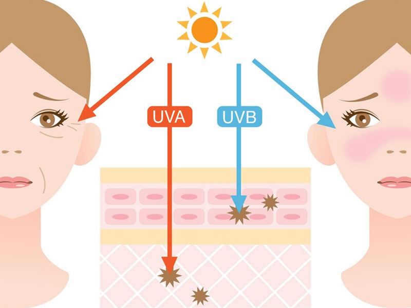 Tia UV đặc biệt là UVA và UVB làm ảnh hưởng đến các tế bào da, thậm chí gây ung thư da
